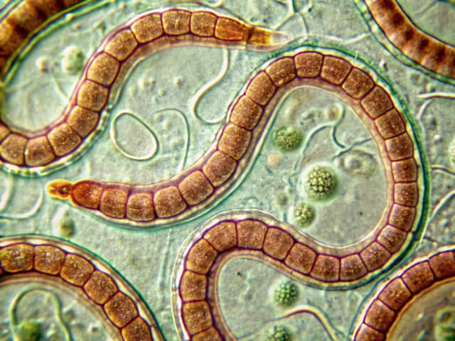 The tapeworm diet dates back to the Victorian era and can have dangerous consequences for your health.