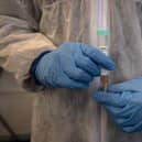 There has been a steep drop in infection rates across Derbyshire