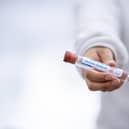 The current number of Covid-19 cases being recorded each week in Derbyshire is significantly higher than the county witnessed in January, before high levels of vaccinations dramatically reduced the figures.