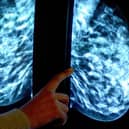 78% of eligible women in Derbyshire attended routine screenings between April 2019 and March 2020