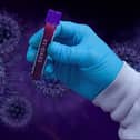 New cases of Covid infections are slowly starting to fall in Derbyshire