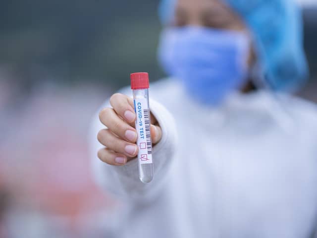 20 Derbyshire council care home staff and residents have tested positive for the virus