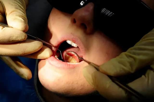 The British Dental Association said the data "understates the level of demand, given huge backlogs