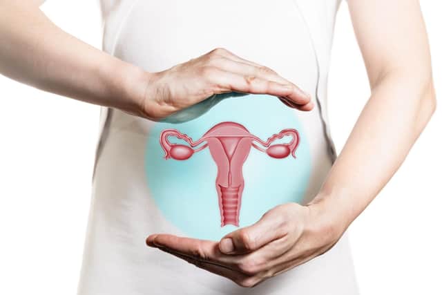 Endometriosis is a painful condition in which tissue similar to the lining of the womb grows in other parts of the body. It is thought to affect around 1.5million people in the UK. (Photo: Getty Images/iStockphoto)