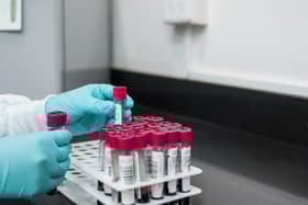 All NHS services in Derbyshire have been ordered to suspend non-urgent testing until September 17.