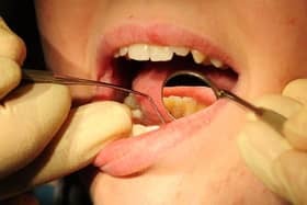 NHS Digital data reveals 168,000 dental treatments were given to NHS patients in Derbyshire between June 2020 and March this year – a 72% drop from 601,000 in the same period the previous year.