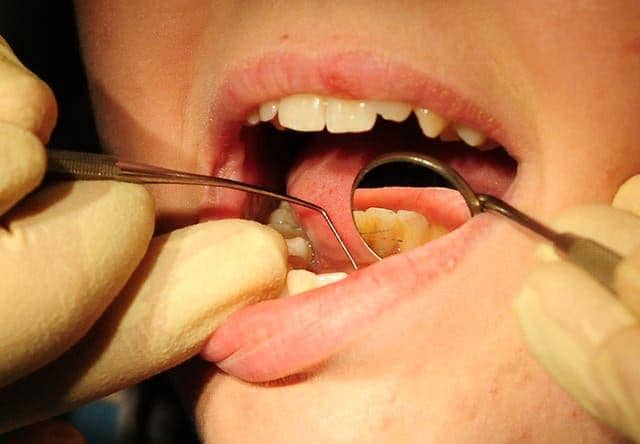 NHS Digital data reveals 168,000 dental treatments were given to NHS patients in Derbyshire between June 2020 and March this year – a 72% drop from 601,000 in the same period the previous year.