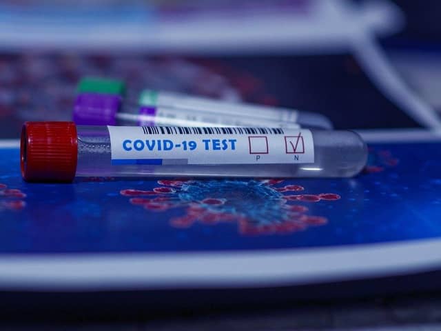 Covid cases in Derbyshire are starting to come down but numbers remain very high