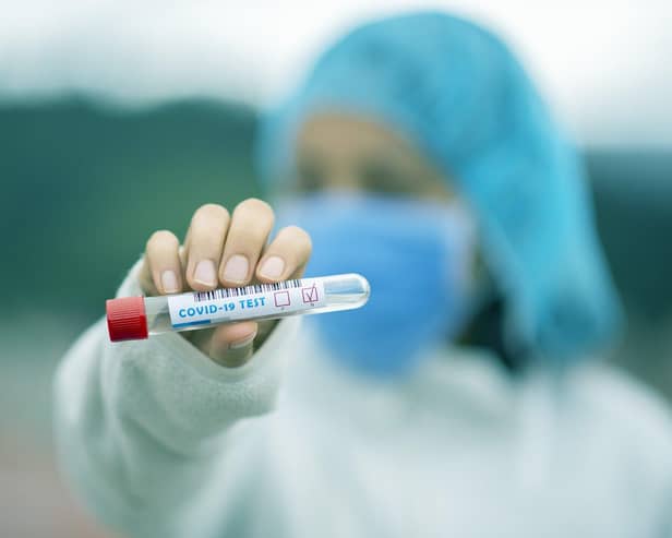 Infection rates across Derbyshire have climbed sharply in recent weeks
