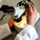 The number of cases of Klebsiella in Derby and Derbyshire has risen over the last six years, new figures show.