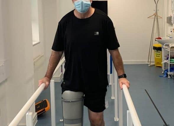 Jim is in physiotherapy while he waits to receive prosthetic limb.