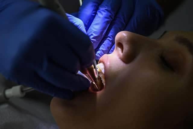Serious drive needed to tackle the dental desert which is the High Peak. (Photo by OZAN KOSE/AFP via Getty Images)