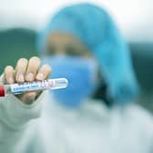 Derbyshire recently recorded more than 800 Covid cases in a day