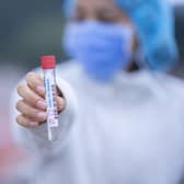 Covid-19 infection rates are rising in Derbyshire