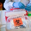 Cases of the Delta variant of Covid-19 - first detected in India - have doubled in four areas of Derbyshire